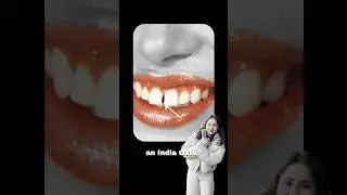 People Are Paying For Teeth Gaps? 😱 - Will You Get The London Gap? | Teeth Trends| Episode -7