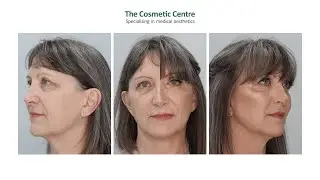 Mel's Journey | The Cosmetic Centre