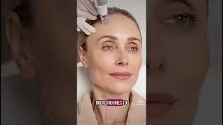 Collagen boost +hydration = skin reset #microneedling #medicalfacial #skinbooster #antiagingskincare