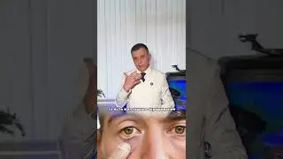 КАК СЕБЕ ПОСТАВИТЬ ДИАГНОЗ ГЕПАТИТ С?