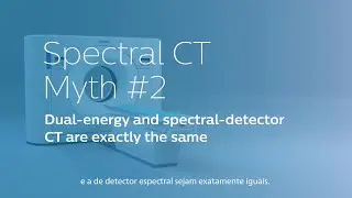 TC Spectral | Mito #2: TC de dupla energia e detector espectral s&atilde;o exatamente os mesmos