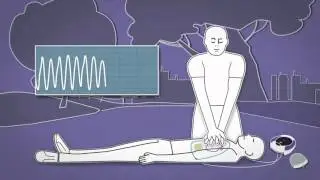 Heartsine's Advanced CPR Advisor 500P