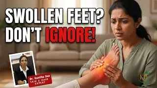 Ankle Swelling Causes & Natural Ayurvedic Solutions for Quick Relief | Dr. Kavitha Dev