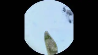 Stained stentor with macronucleus visible, 10x objective