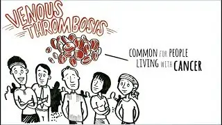 VTE and Cancer