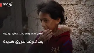 الطفل محمد يحلم بإجراء عملية تجميلية بعد تعرضه لحروق شديدة في جسده#أبشر_بالخير