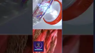 Erectile Dysfunction Treatment With Shock Wave #shorts #education