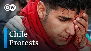 Chile's police accused of deliberately shooting protesters in the face | DW News