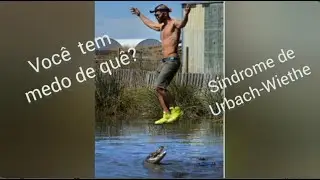 Voc&ecirc; tem medo de qu&ecirc;? De nada? Ent&atilde;o cuidado! Voc&ecirc; pode ter a s&iacute;ndrome de Urbach-Wiethe!