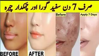 Besan Face pack for glowing skin | Homemade Face Wash | Face pack forglowing skin