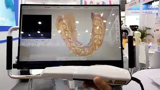 Best Dental Intraoral Scanner Review