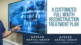 A Customized Full Mouth Reconstruction Treatment Plan For You Under One Roof