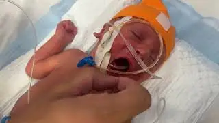Professional OG Tube Care & Mouth Suctioning for a Newborn in NICU 💖👶