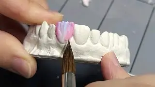 ASMR Sounds and Shapes / Effects on Dental Aesthetics / Ceramic Layering
