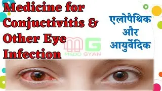 Conjuctivities/Pink Eye Ayurvedic Allopathic Treatment (in Hindi)|Ciplox|Nephacool|Triphala Water