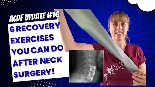 ACDF Recovery #16: Try These Top Physical Therapy Tricks for Neck Relief!