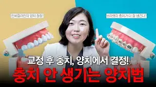 교정 후 충치, 양치에서 결정! 충치 안 생기는 양치법👀