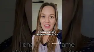 Acne Skincare vitamins | Acnetame review #skincareroutine #skincareproducts