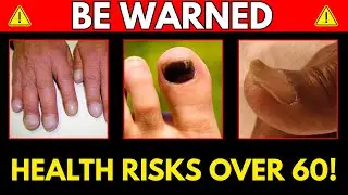 Your Nails Don't Lie: What Color, Shape, and Texture Reveal About Your Health (60+)