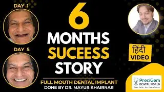 Full Mouth Dental Implants Treatment🦷 | Permanent Digestion & Health Solution - Dr Mayur Khairnar