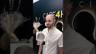 WATCH this Amazing Hair Transplant | 3500 Grafts Before and After