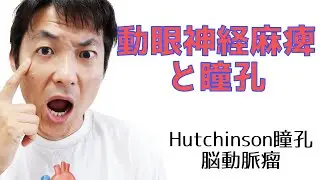 Hutchinson瞳孔と脳動脈瘤による瞳孔不同：瞳孔(Part.７)