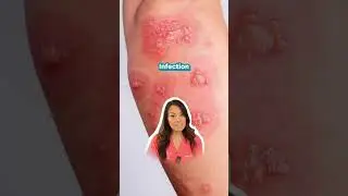 When our skin barrier is healthy, it performs two main jobs
