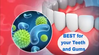Rebuild Your Gums And Teeth With This Soft Mineral