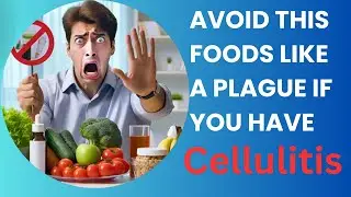 Eat THIS Not THAT for Cellulitis Relief!