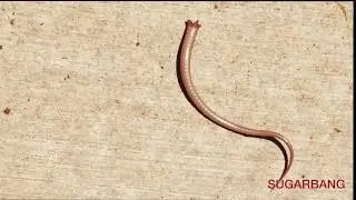Brain Worm Caught On Camera