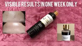 @skindeepinternational CLEAN SWEEP honest review ! 2% BHA Pore Minimising Toner |