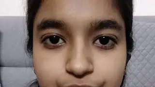 Day 23👁️ 90 Days  Eye helath : Wrinkle reduction 🌟#wrinklereduction #eyeyoga # glowing face
