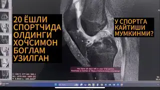 Олдинги хочсимон боғлам (ПКС, крест пай) узилганда операциядан кейин спортга қайтиш мумкинми?