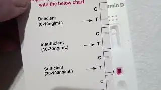 Ein Vitamin D Labortest w&auml;re angebracht...
