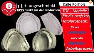 Funktionelle Meister-Modelle f&uuml;r die Totalprothetik: F&uuml;r den analogen und digitalen Workflow.