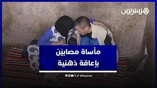 تحوّل جسداهما إلى هياكل ضامرة .. مرض نادر يتسبب في مأساة مصابين بإعاقة ذهنية ببني عياط