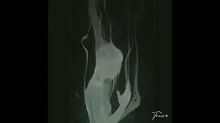 [ FREE ] -  REGRET | Deep Melodic Trap Beat