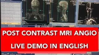 Протокол TRICKS МР-ангиографии, позиционирование, планирование