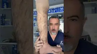 Realistic Scosmetic prosthetic/Excellent product #bestcare_medical_dubai #best_prosthetic
