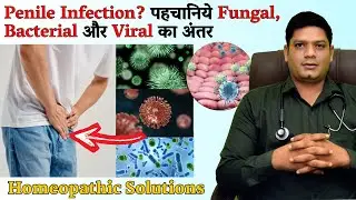 Recognize the Difference Between Fungal, Bacterial, and Viral Penile Infection? | Dr Sunil Patidar