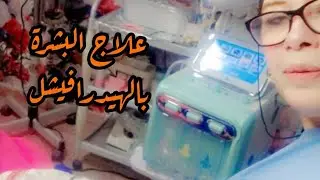 تقشير البشرة وشفط الذهون بحمض سليسيليك.skin scrubber ,vaccum et ultrason ,extractio de comédons