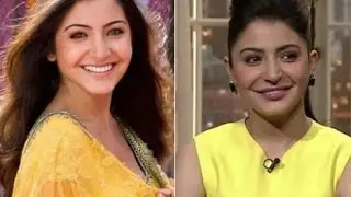 Anushka Sharma Before and After Plastic Surgery Photos