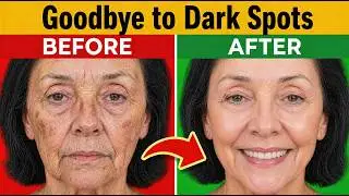 1 Vitamin Removes Dark Spots Over 60 | Senior Health Tips