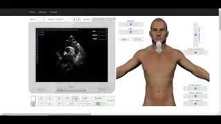 Suprasternal View Long axis of Aorta. Color Doppler.