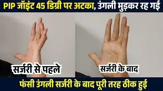 उंगली में चोट लगी? सिर्फ 21 दिन में उंगली की जाम समस्या का हल | Finger Stiffness