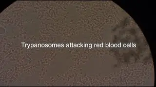 Trypanosomes attacking red blood cells