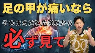 【激痛】足の甲が痛む本当の原因は◯◯でした。湿布を貼る前にこれだけ見て！