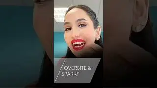 How @Amenakhan corrects her overbite with Spark&trade; Clear Aligners 🪢