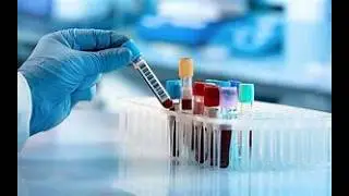 Nebraska's old Blood Test Marriage Law! #viral #facts #foryou #history #funny #lol #viralshorts