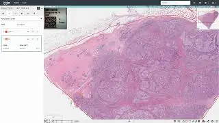 Leveraging a Collaborative Image Management Platform for Multi Site Image Analysis Collaborations